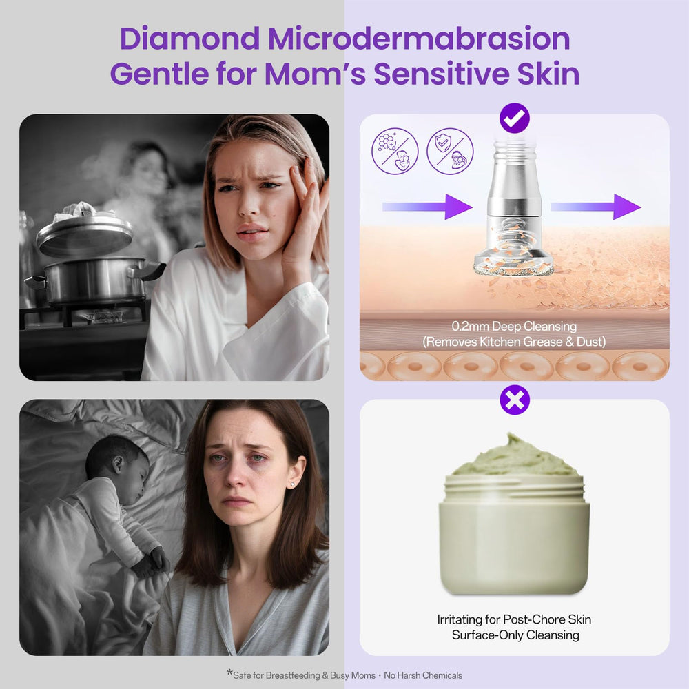 UNOISETION Diamond Microdermabrasion Machine kit included shows complete home-use setup.