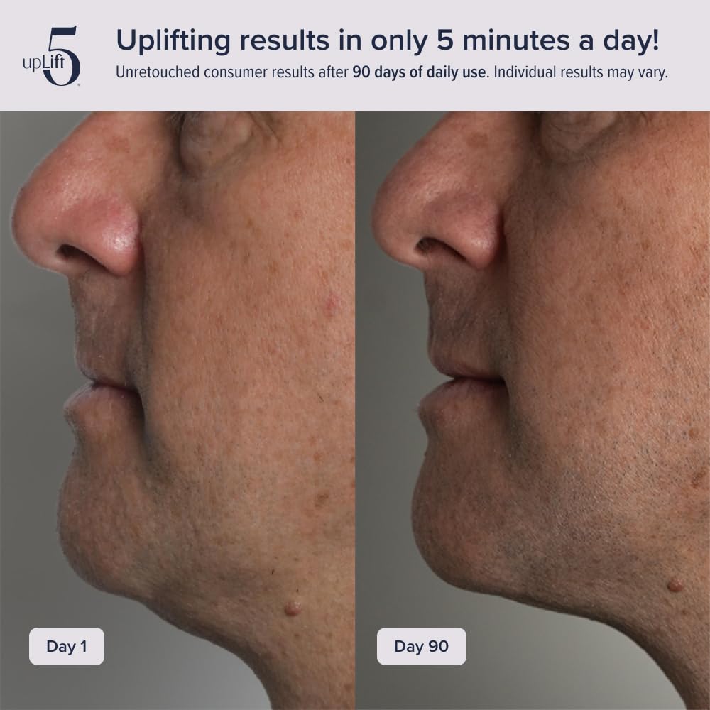 upLift 5 neck-and-jawline-toning demonstration for tightened facial contours.