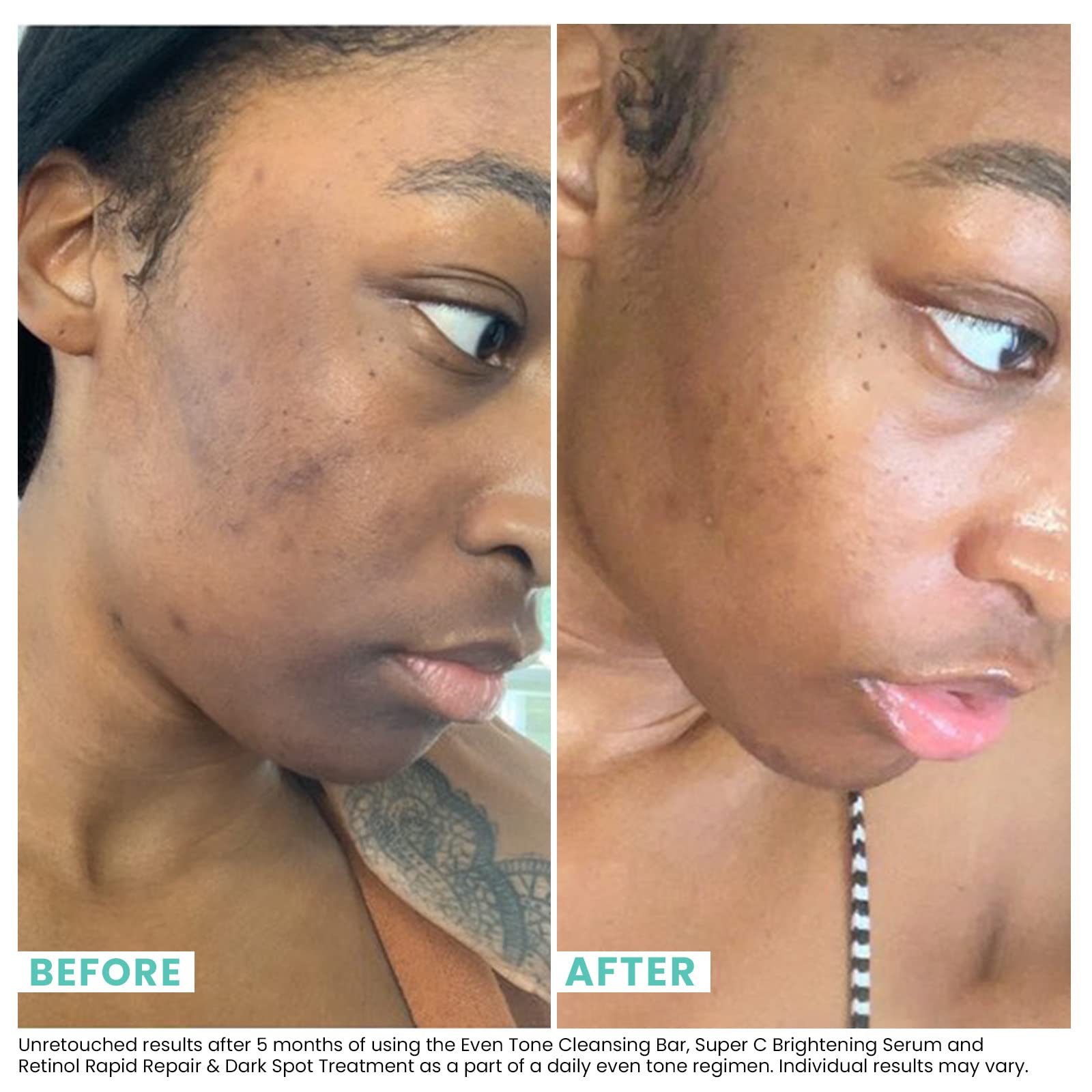Urban Skin Rx 3in1 bar used as a rejuvenating mask with a 3-5 minute rest.