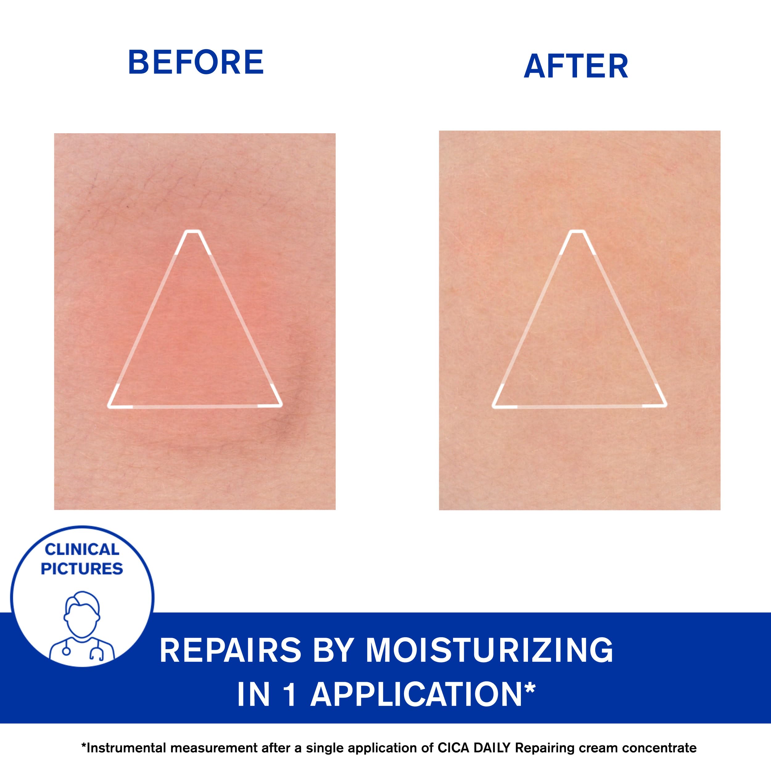 Uriage Cica-Daily hyaluronic-acid focus shows plumping hydration without heaviness.