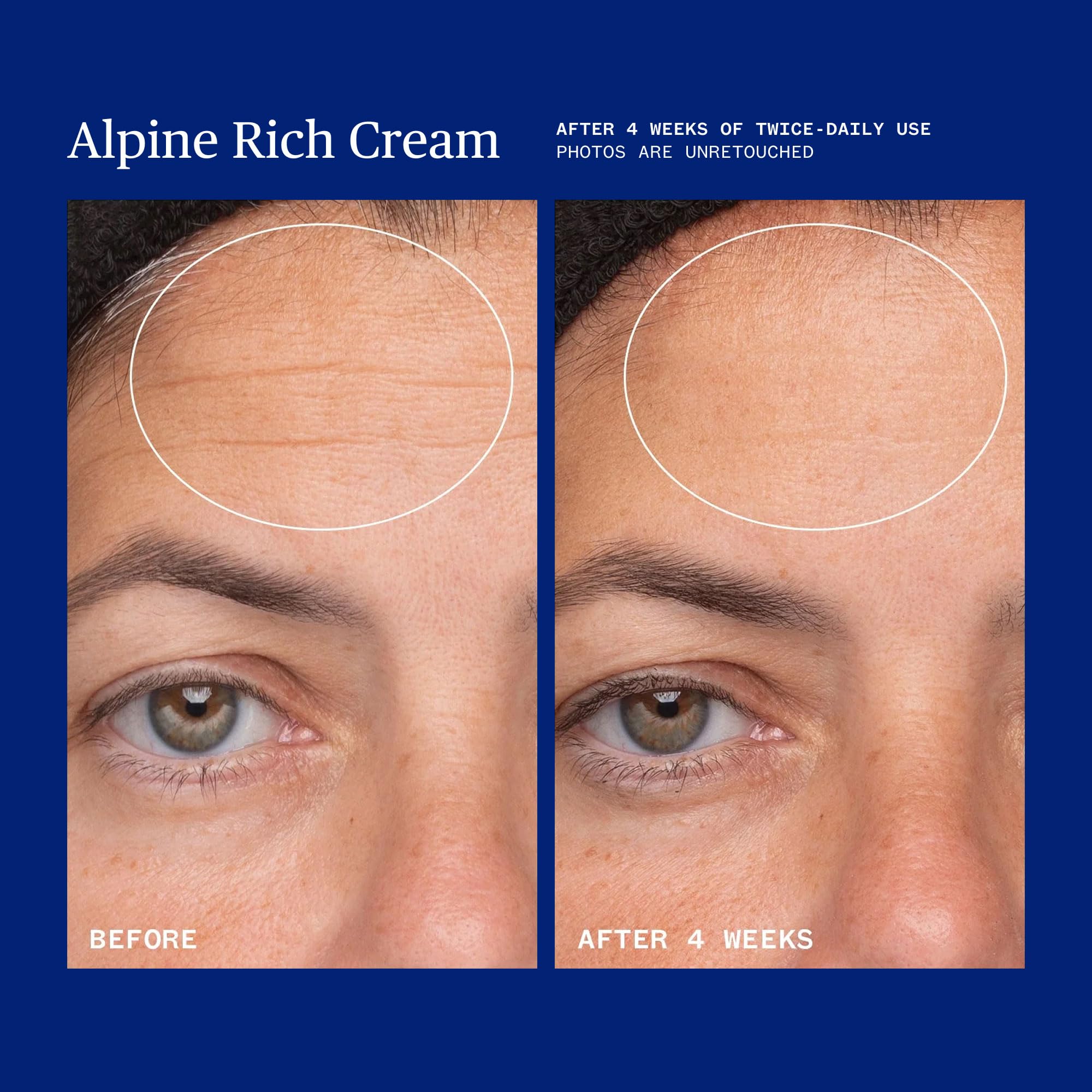 Ursa Major Alpine Rich Cream on dry hands showing deep moisturization.
