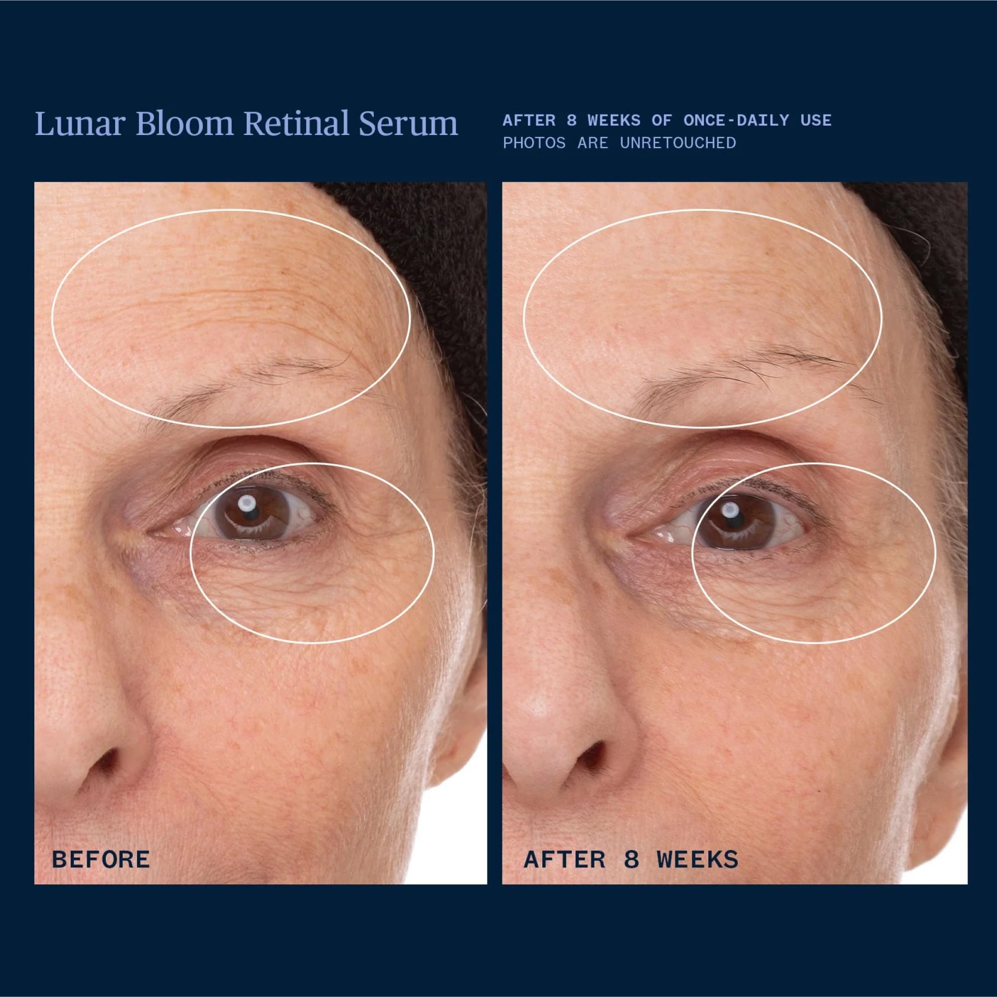 Ursa Major Lunar Bloom Serum gardenia-stem-cells support collagen and elastin.