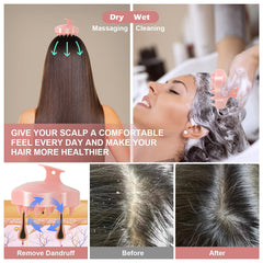URTHEONE dandruff-relief scalp brush targets itchy scalps with soothing bristles