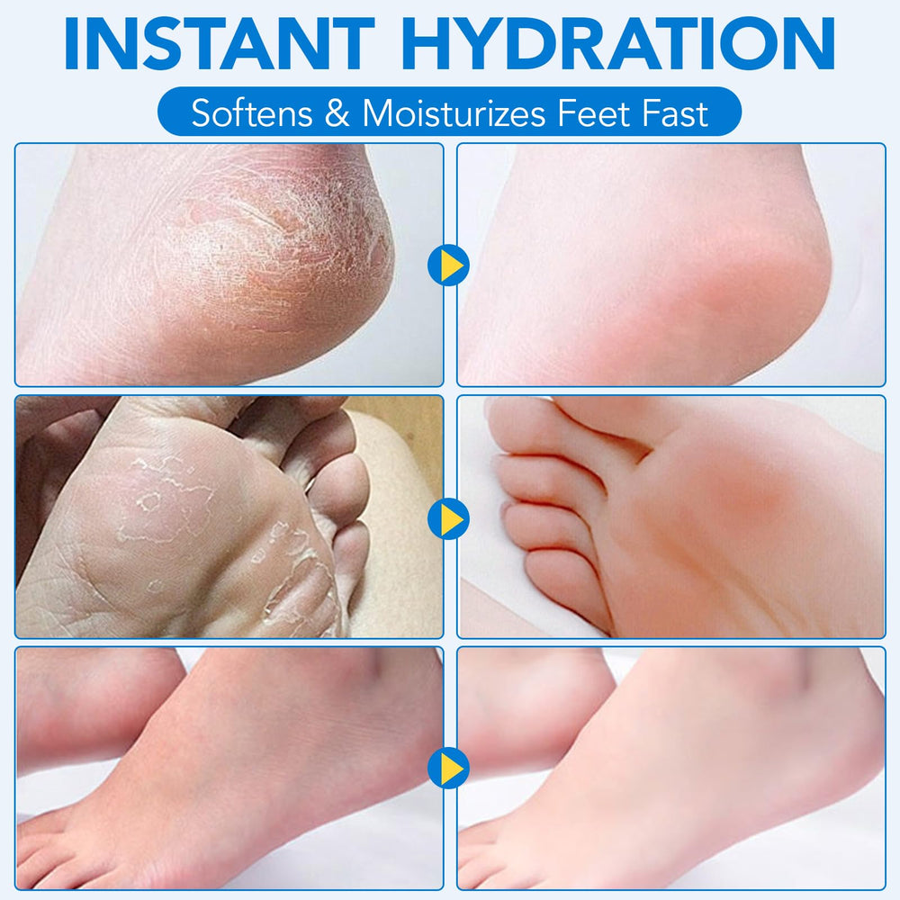 Uruses Multi-area Care image shows application on feet, hands, knees