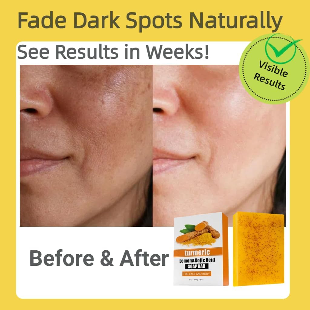 Uselective turmeric-lemon-glow-soap-bar-lemon-turmeric-visual emphasizes refreshing skin ritual.