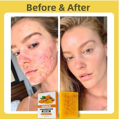 Uselective turmeric-lemon-glow-soap-bar-vitamin-c-enriched for even-looking tone.