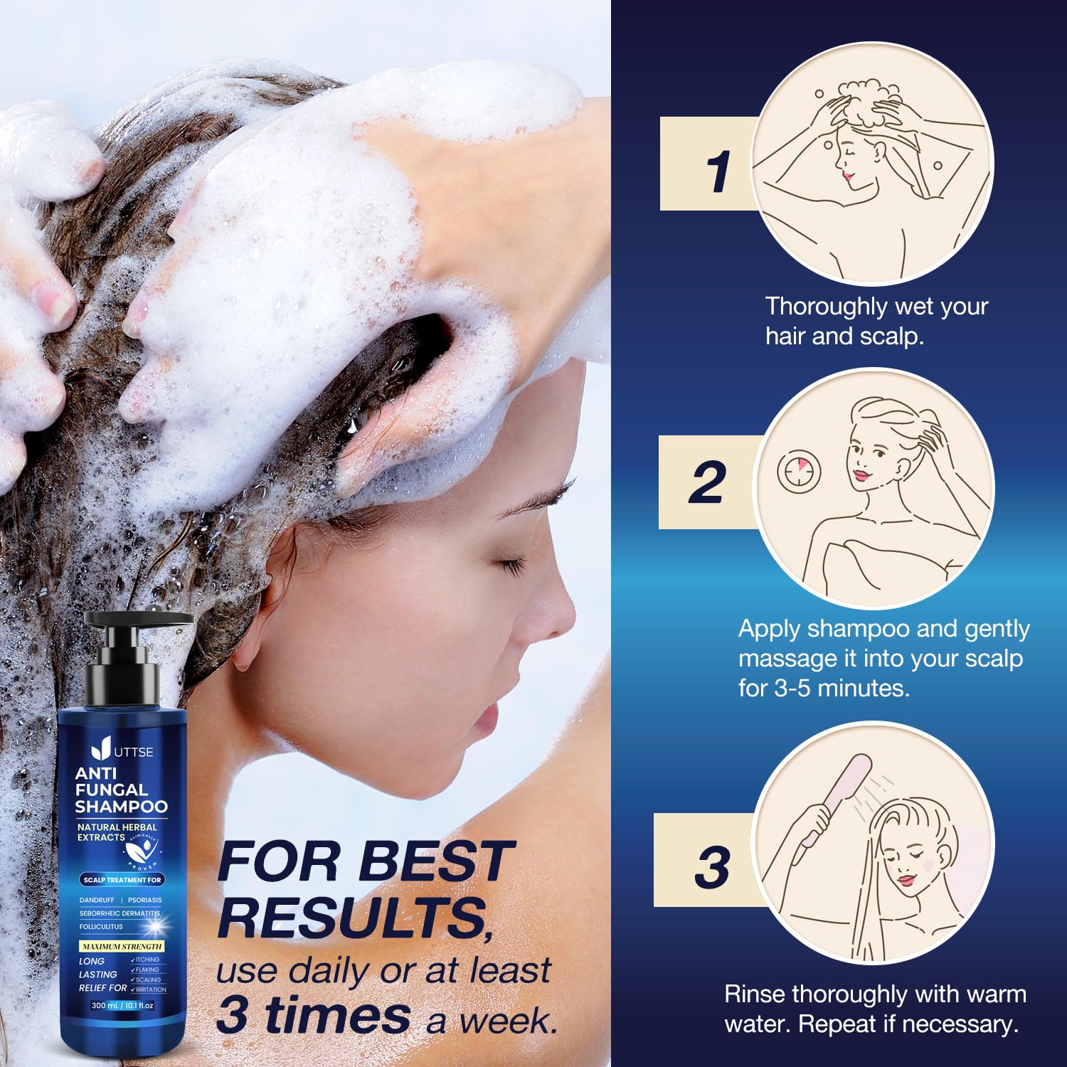 Uttse anti-fungal shampoo 300 ml bottle for daily scalp care.