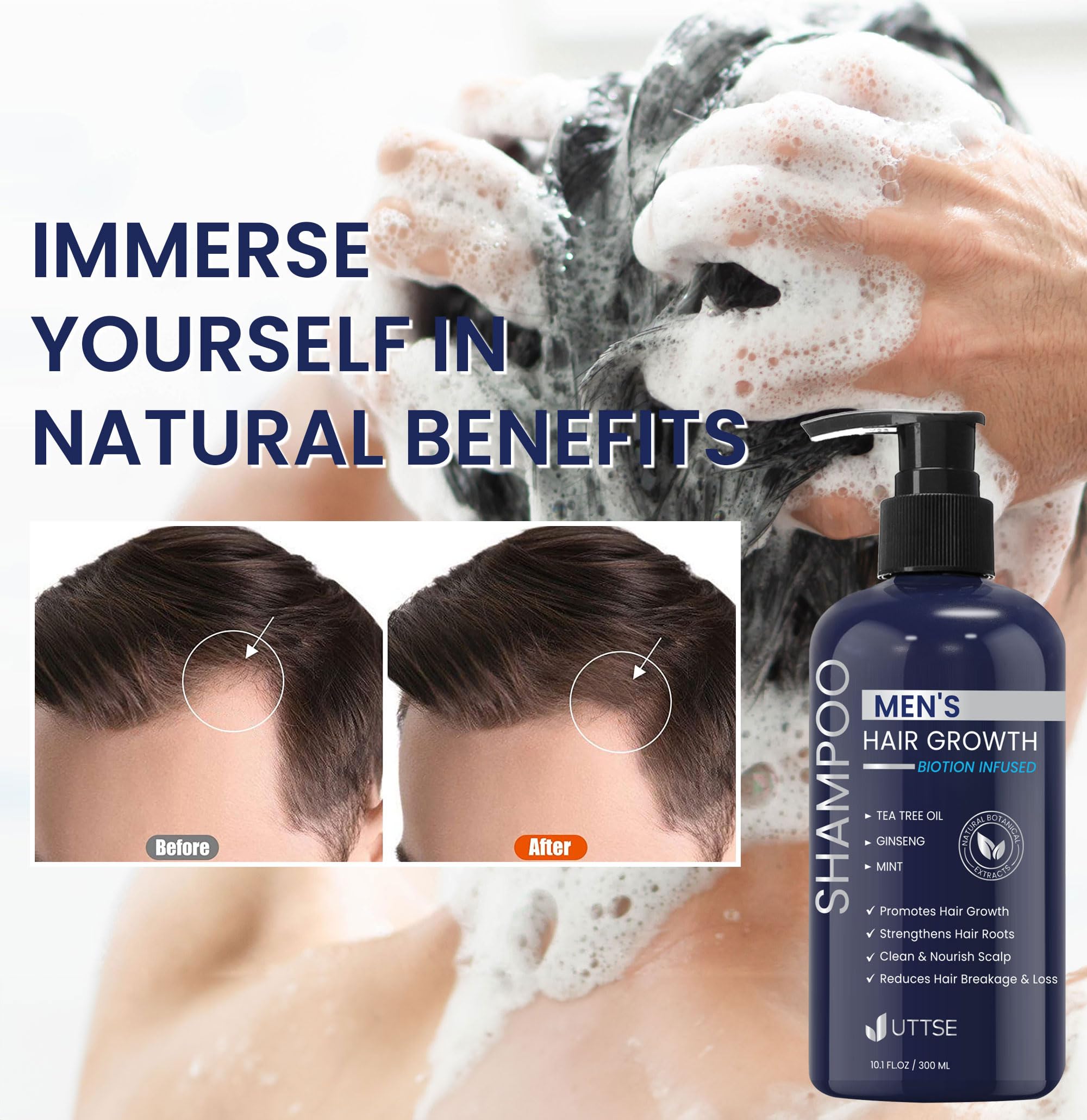 Uttse Biotion Shampoo bottle beside mirror evoking scalp refresh and calm