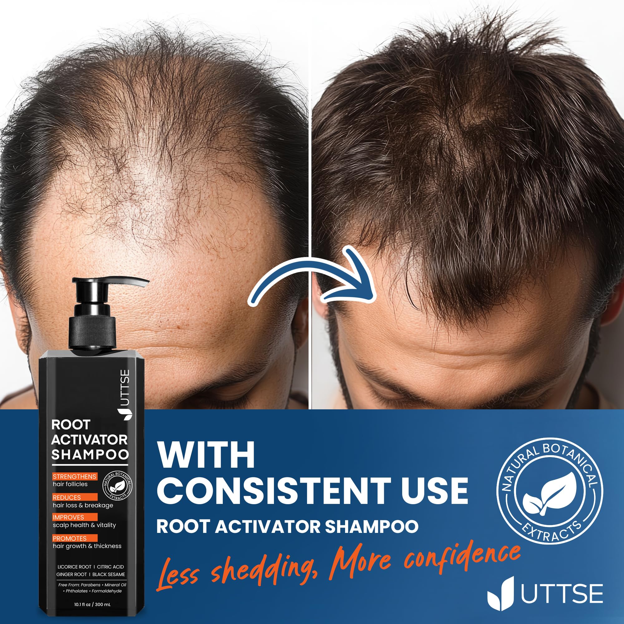 Uttse Root Activator Shampoo ready for daily-use routine