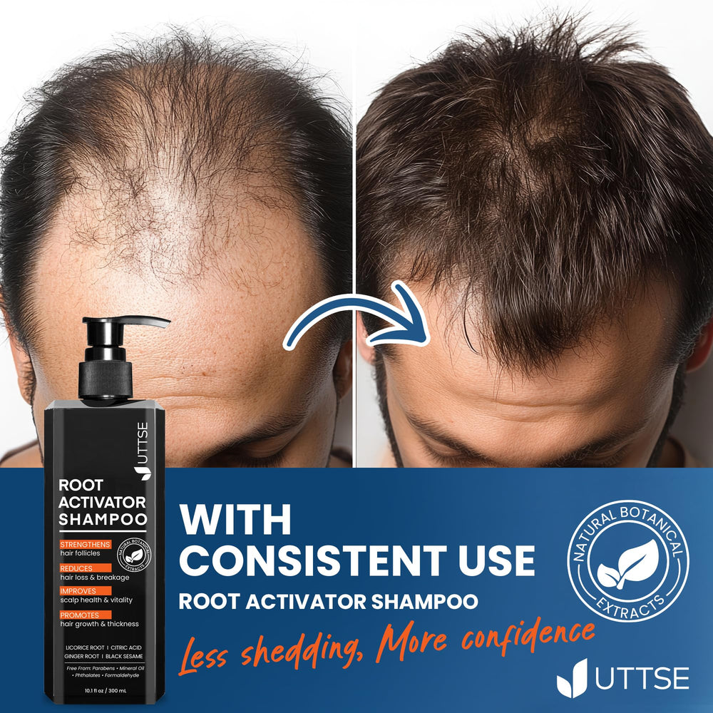 Uttse Root Activator Shampoo ready for daily-use routine