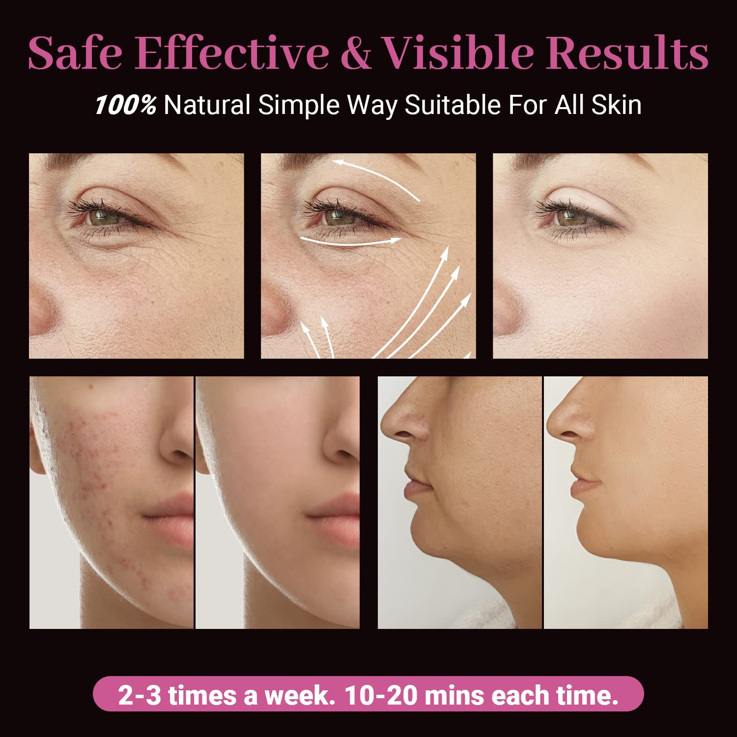 UUPAS mushroom tube for larger-area application with even treatment along skin surface.