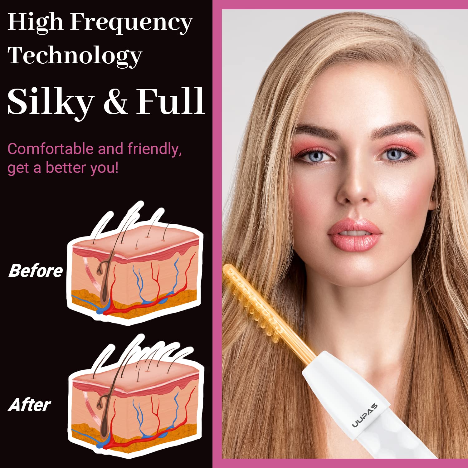 UUPAS tongue tube allows precise contact on small sensitive areas.