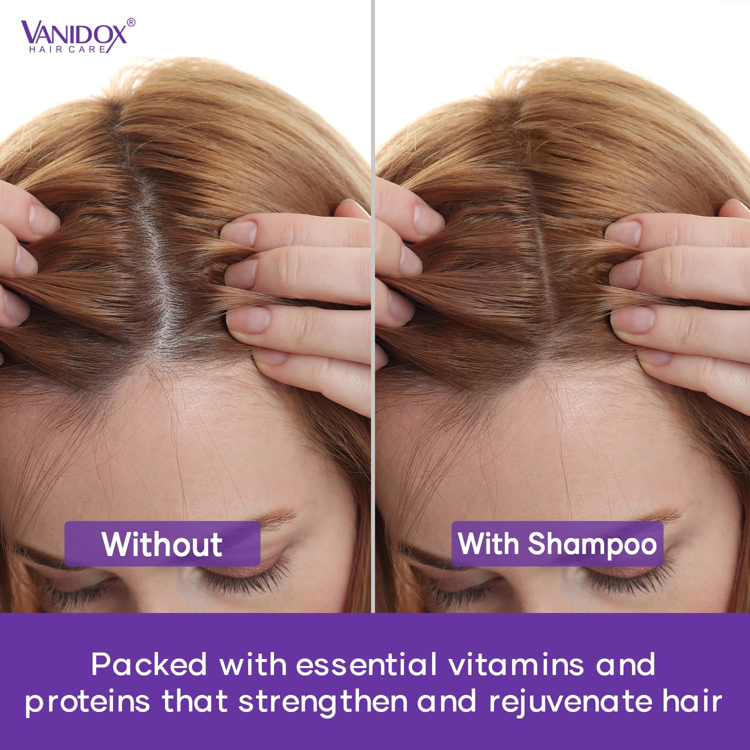 Vanidox Ingredients bottle arrangement showcases natural blends for nourished scalp and hair.