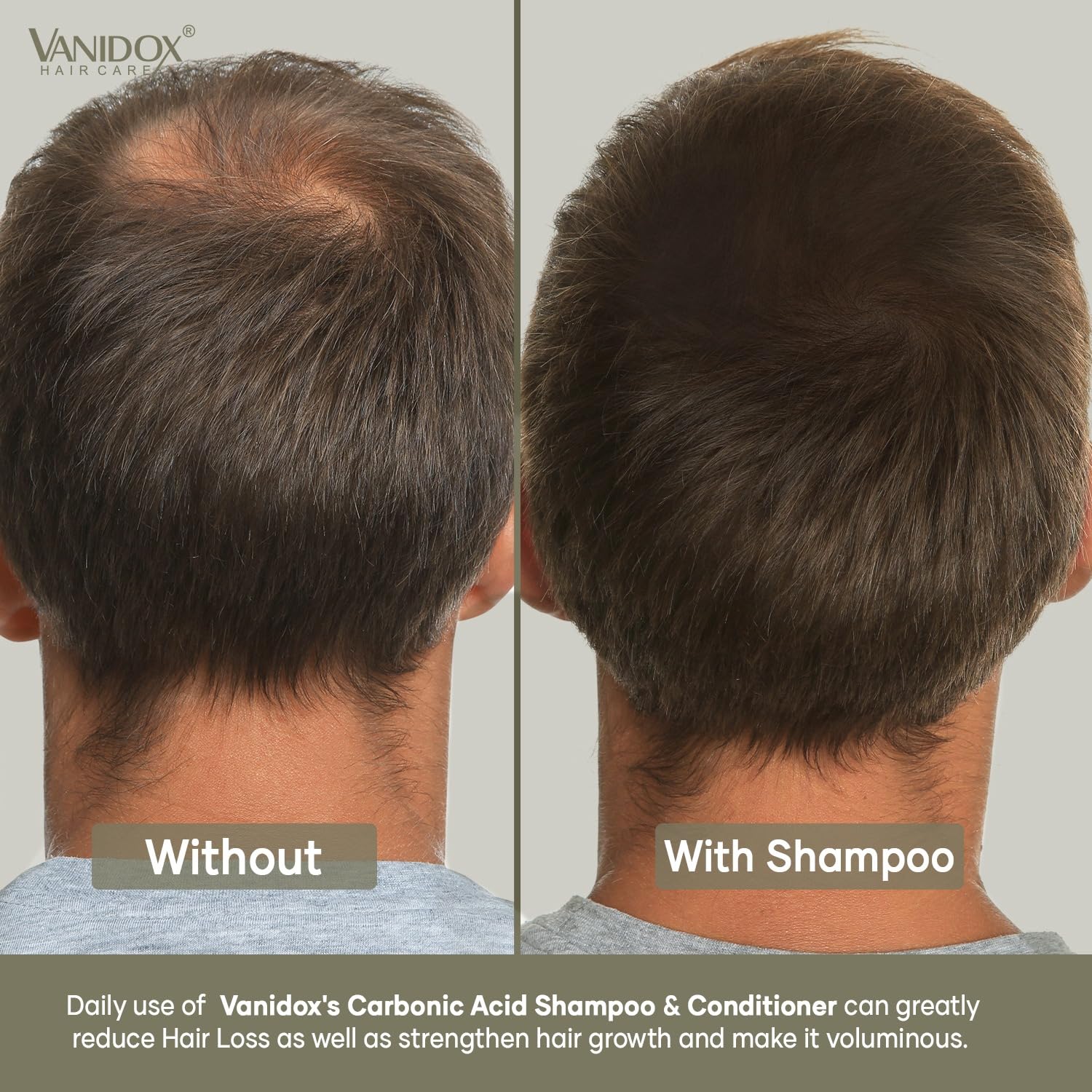 VANIDOX Moroccan argan oil packaging highlights nourishing natural ingredients.