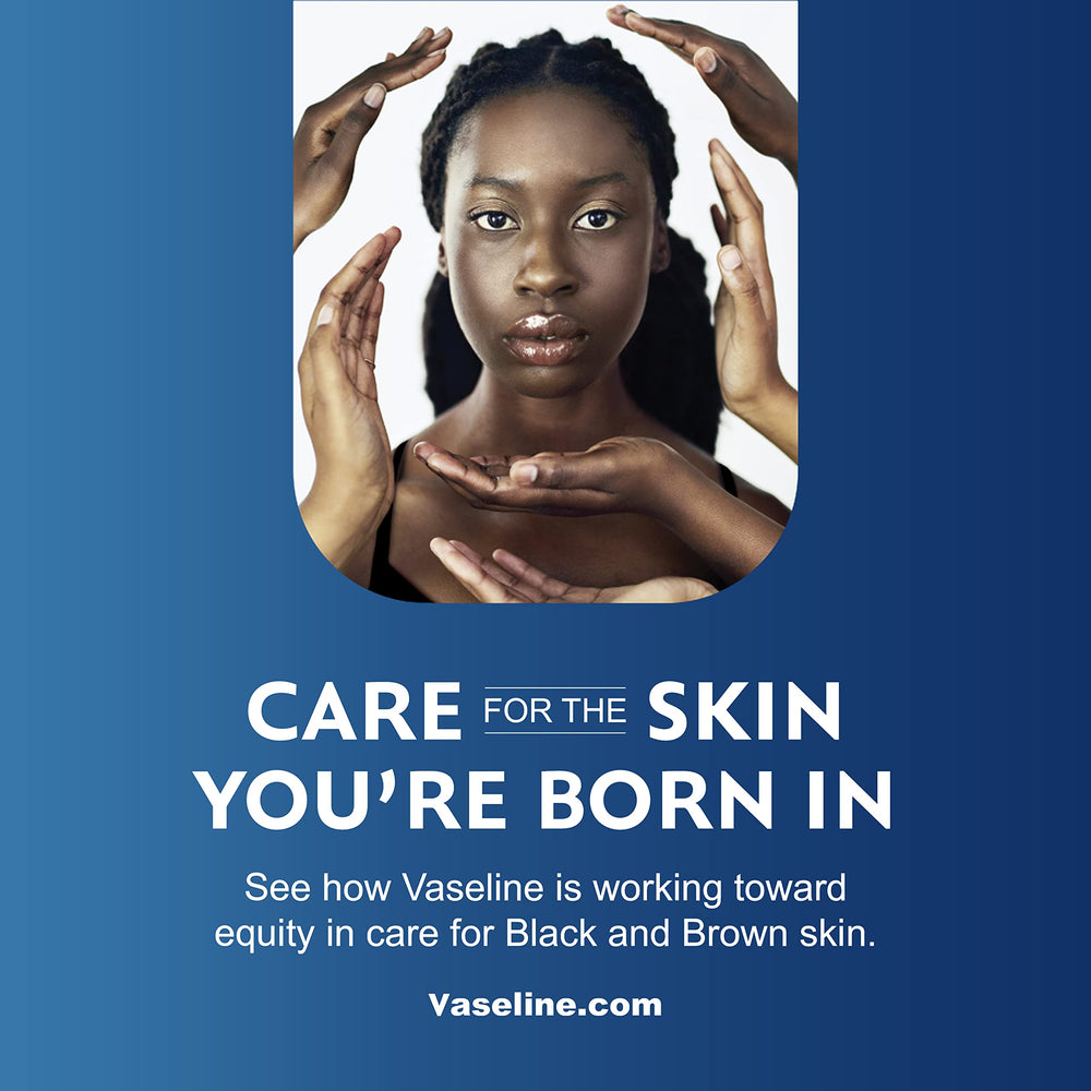 Vaseline lotion on hand showing non greasy finish and smooth skin