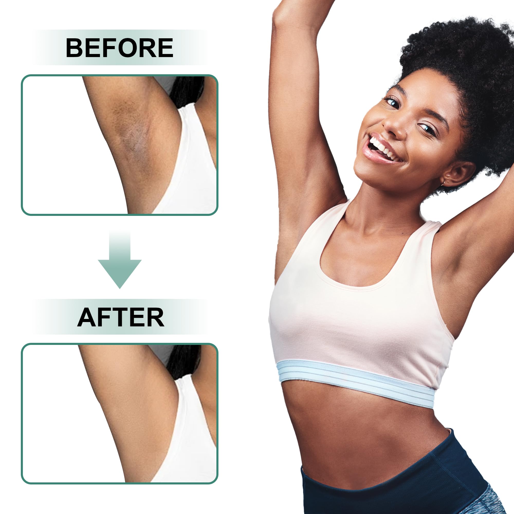 VCETREE bikini area shot emphasizes discreet use and gradual tone-evening.
