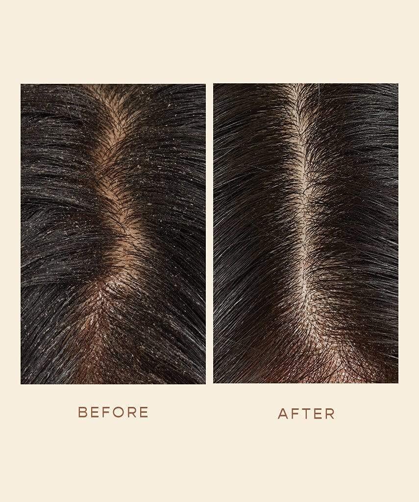 Vegan formula badge on GRO Scalp Detoxifying Serum for clean beauty.