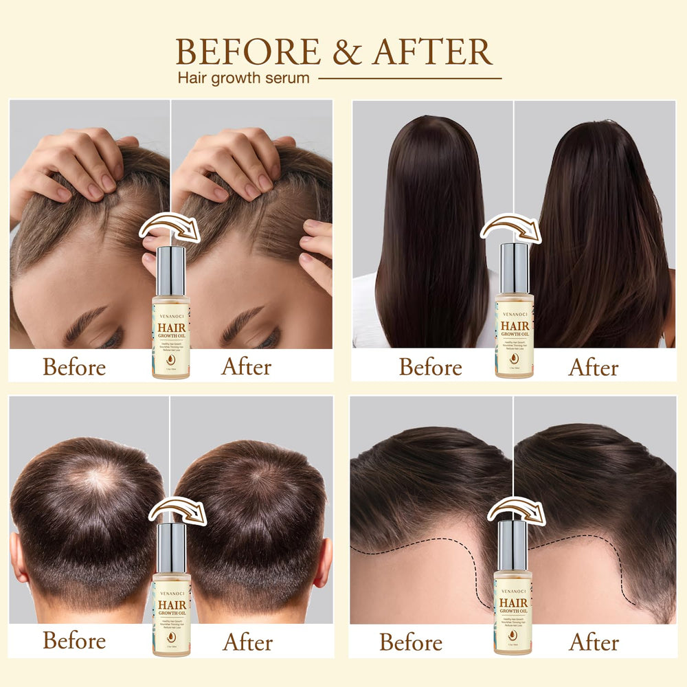 Applying Venanoci hair growth oil for scalp massaging benefits
