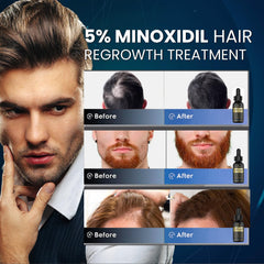 Venanoci minoxidil application dropper ready for scalp use supports regrowth possibilities.