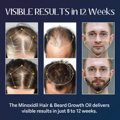 Venanoci minoxidil serum bottle closeup shows potent formula.