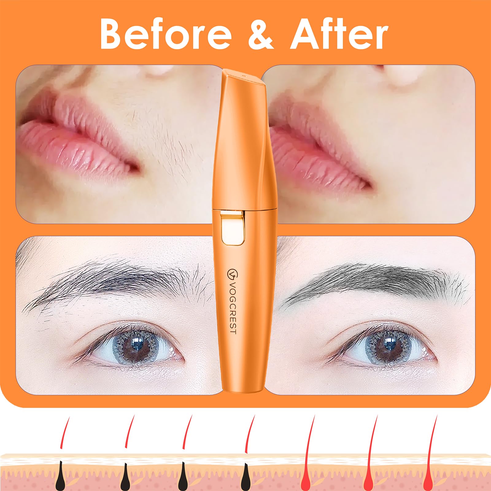 VG VOGCREST No nicks or cuts promotes gentle, painless maintenance.