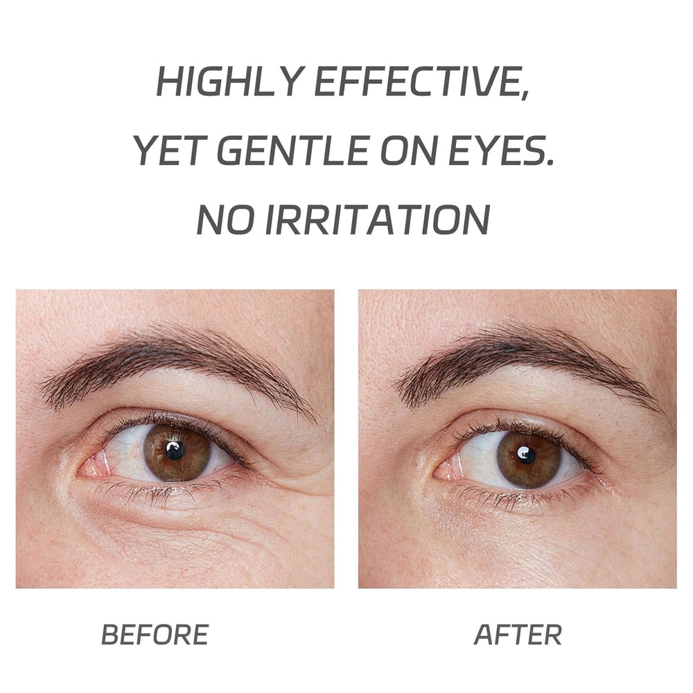 VGO Eye Cream fast-absorbing finish dries quickly with a comfortable feel.