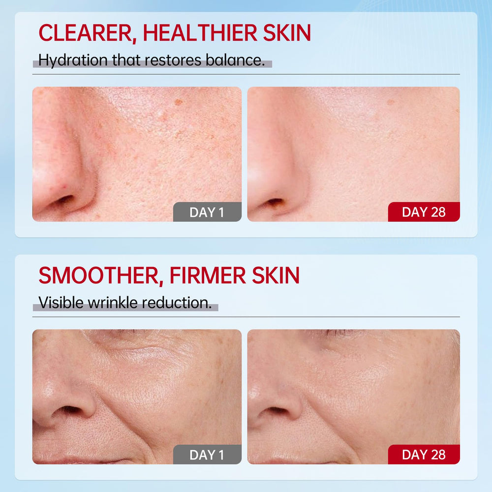 VGO Snail Mucin 92% Moisturizer; hyaluronic acid hydrates deeply.