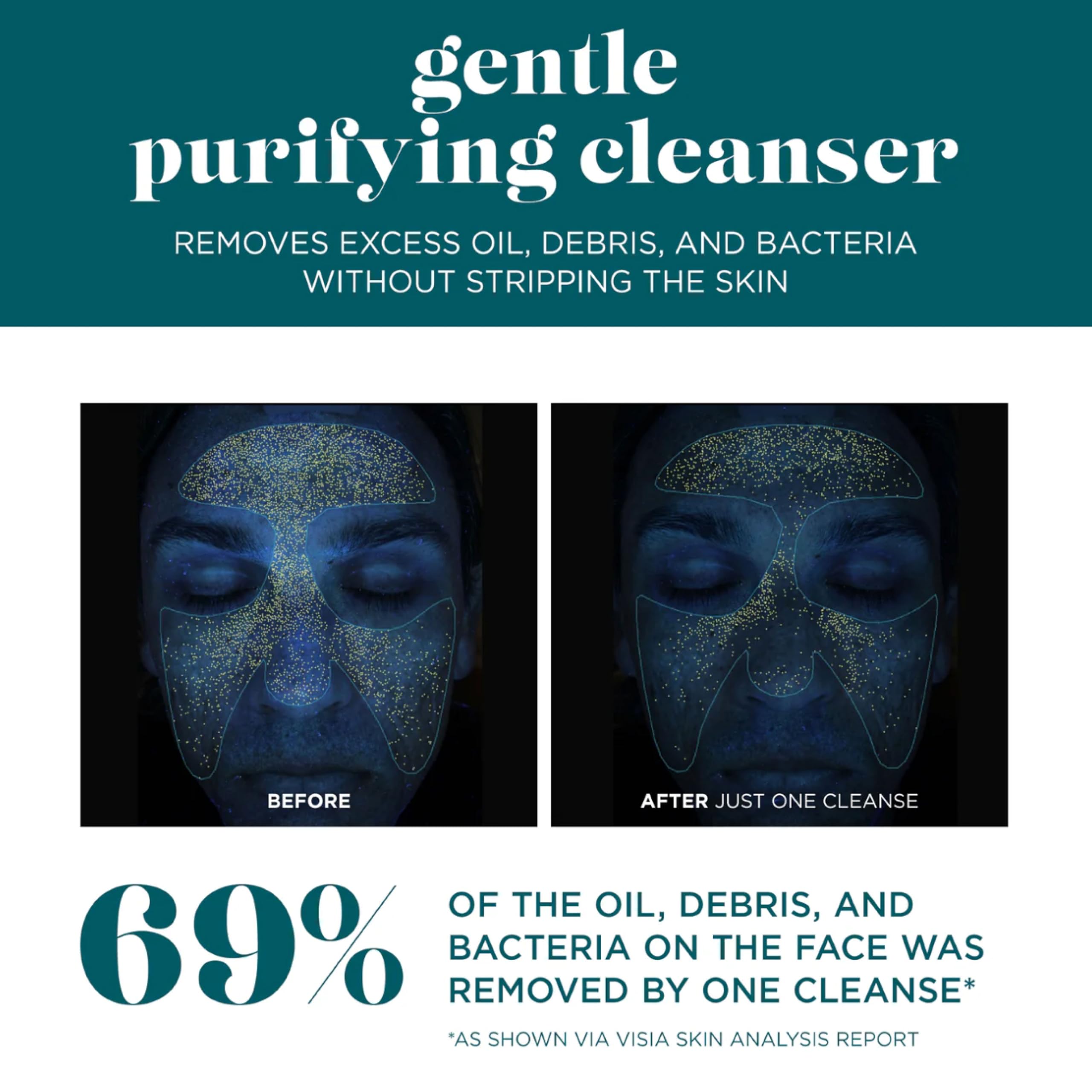 VI DERM fragrance-free cleanser supports a balanced daily skincare routine