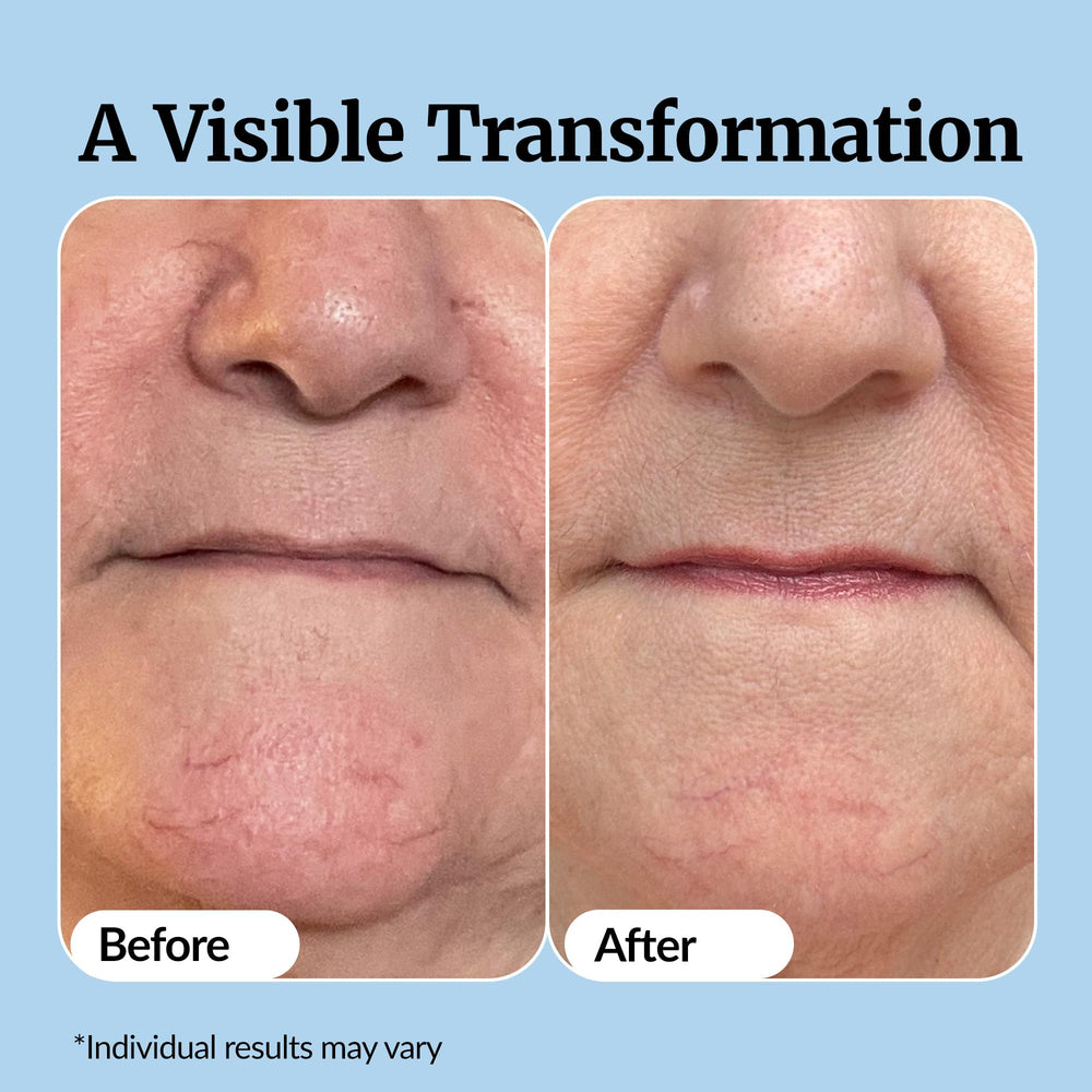 Vibriance Super C Serum lemon-based base emphasizes potent vitamin C source.