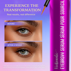 VieBeauti Lash Serum bottle with ingredients focus illustrates gentle, daily-use formula for sensitive eyes.