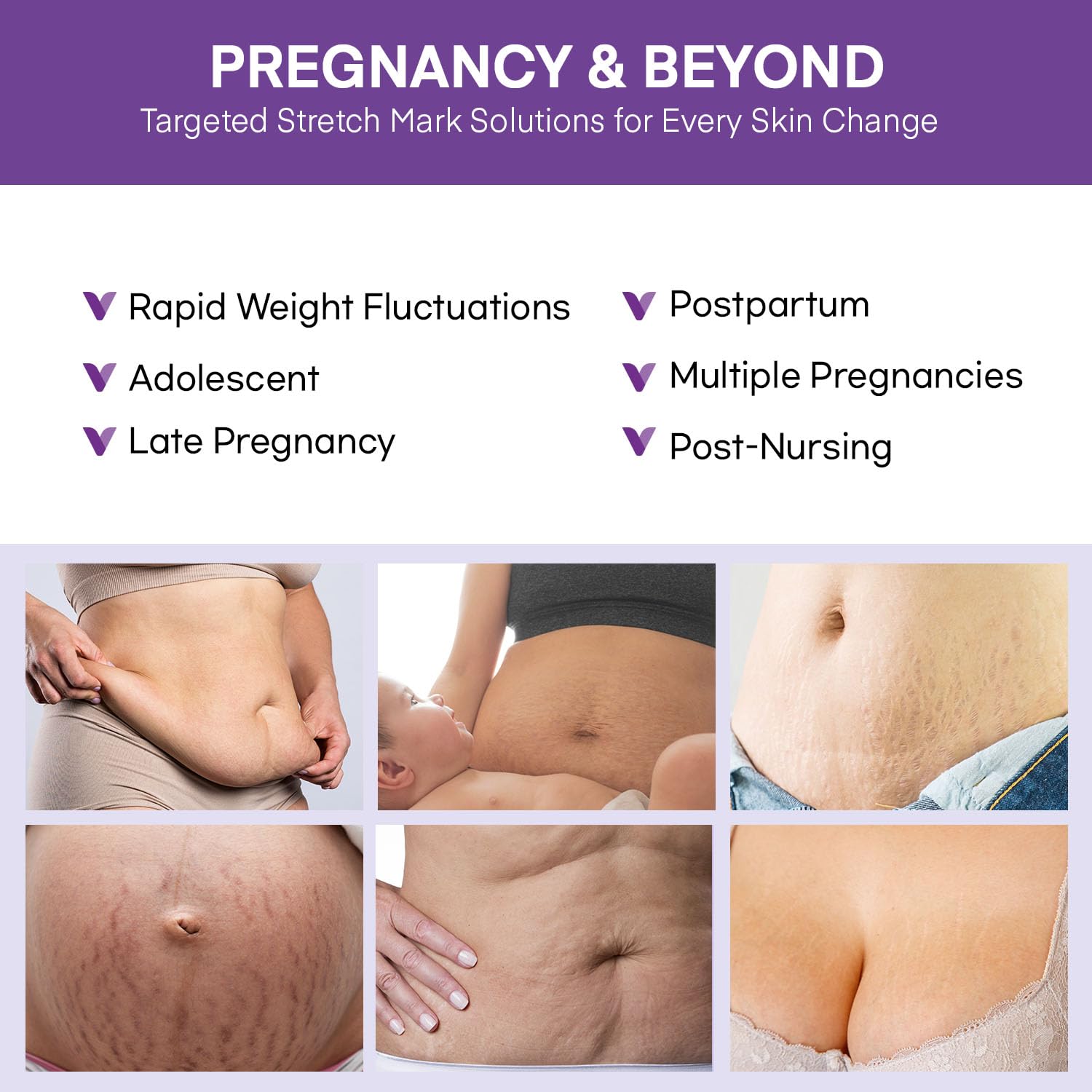 Vigority-belly-cream-massage-application demonstrates soothing skin care on the belly.