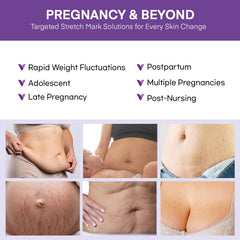 Vigority-belly-cream-massage-application demonstrates soothing skin care on the belly.