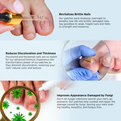 VigorWell complete nail repair solution visual highlighting comprehensive kit.