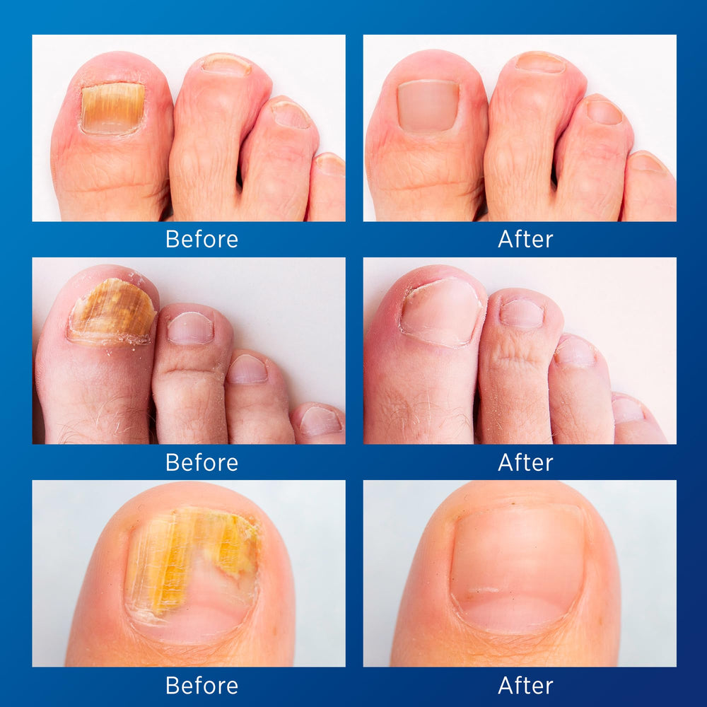 VigorWell nighttime patches in action delivering eight hours of care.