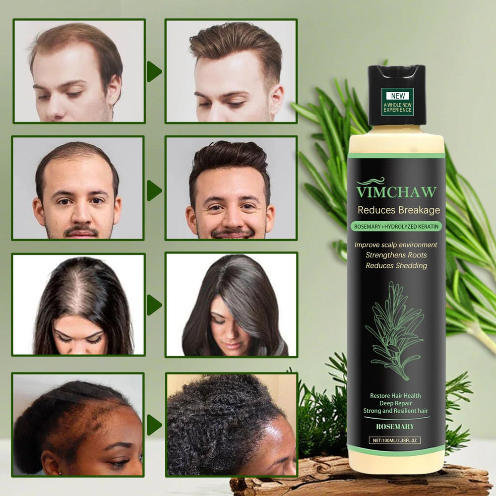 Vimchaw rosemary shampoo packaging three-pack showcases value and consistent care.
