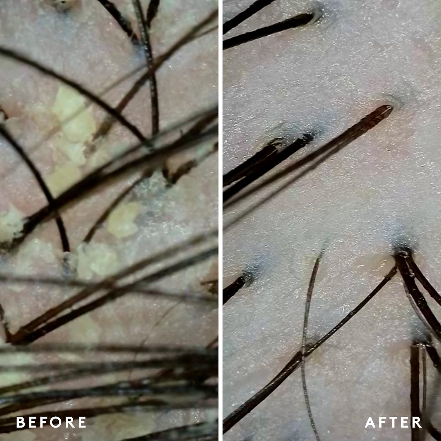 VIRTUE Exfoliating Scalp Scrub suggests a weekly spa-like treatment