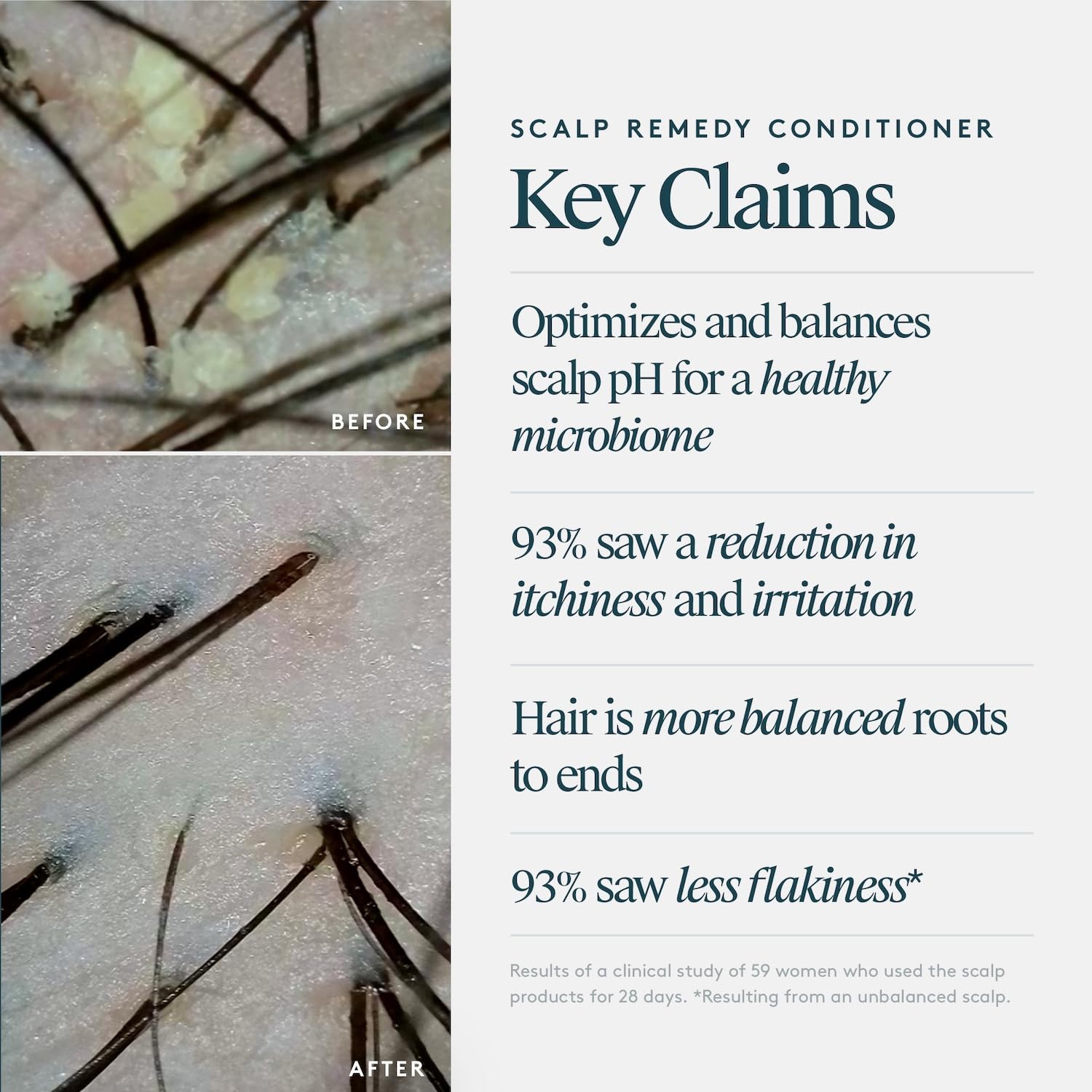 VIRTUE Scalp Remedy applied to scalp demonstrates nourishing, soothing coverage