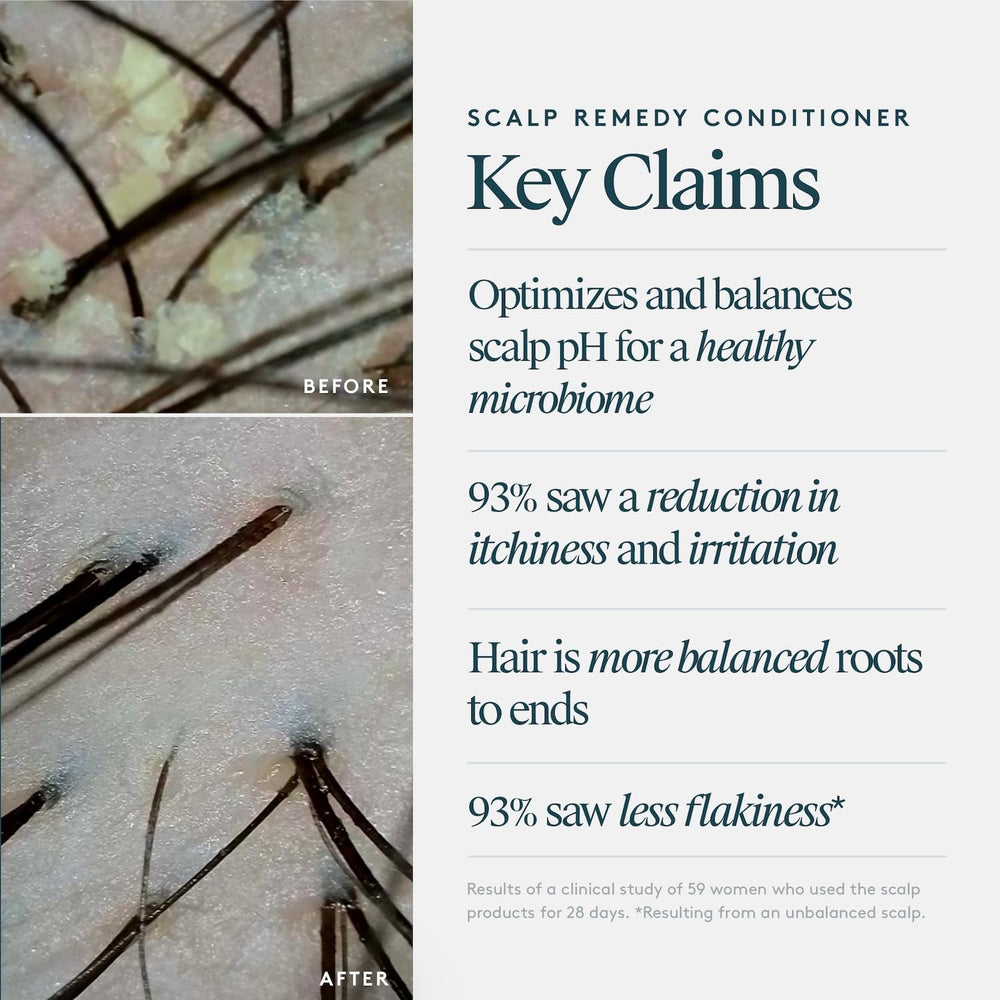 VIRTUE Scalp Remedy applied to scalp demonstrates nourishing, soothing coverage