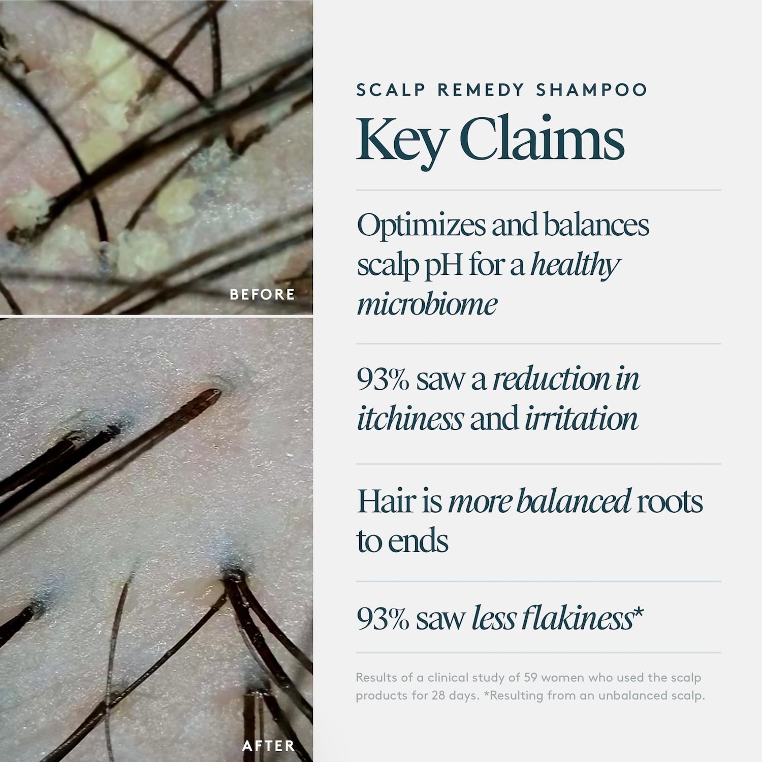 VIRTUE Scalp Remedy Shampoo fragrance-free label emphasizes purity