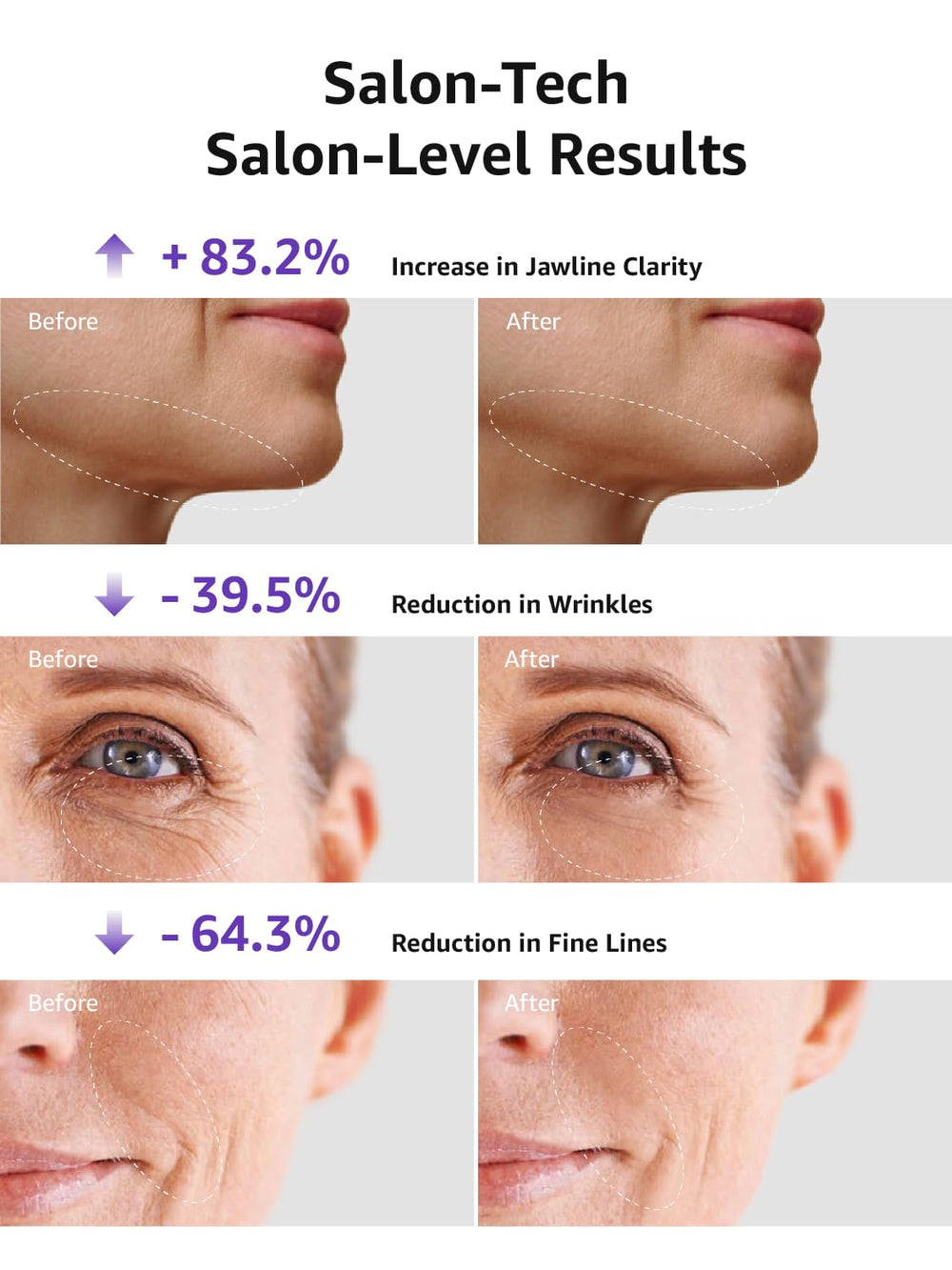 VITALY Glow rapid heat-up in three seconds for quick treatments