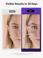 VITALY Glow smart safety features with AI-NTC sensors for safe sessions