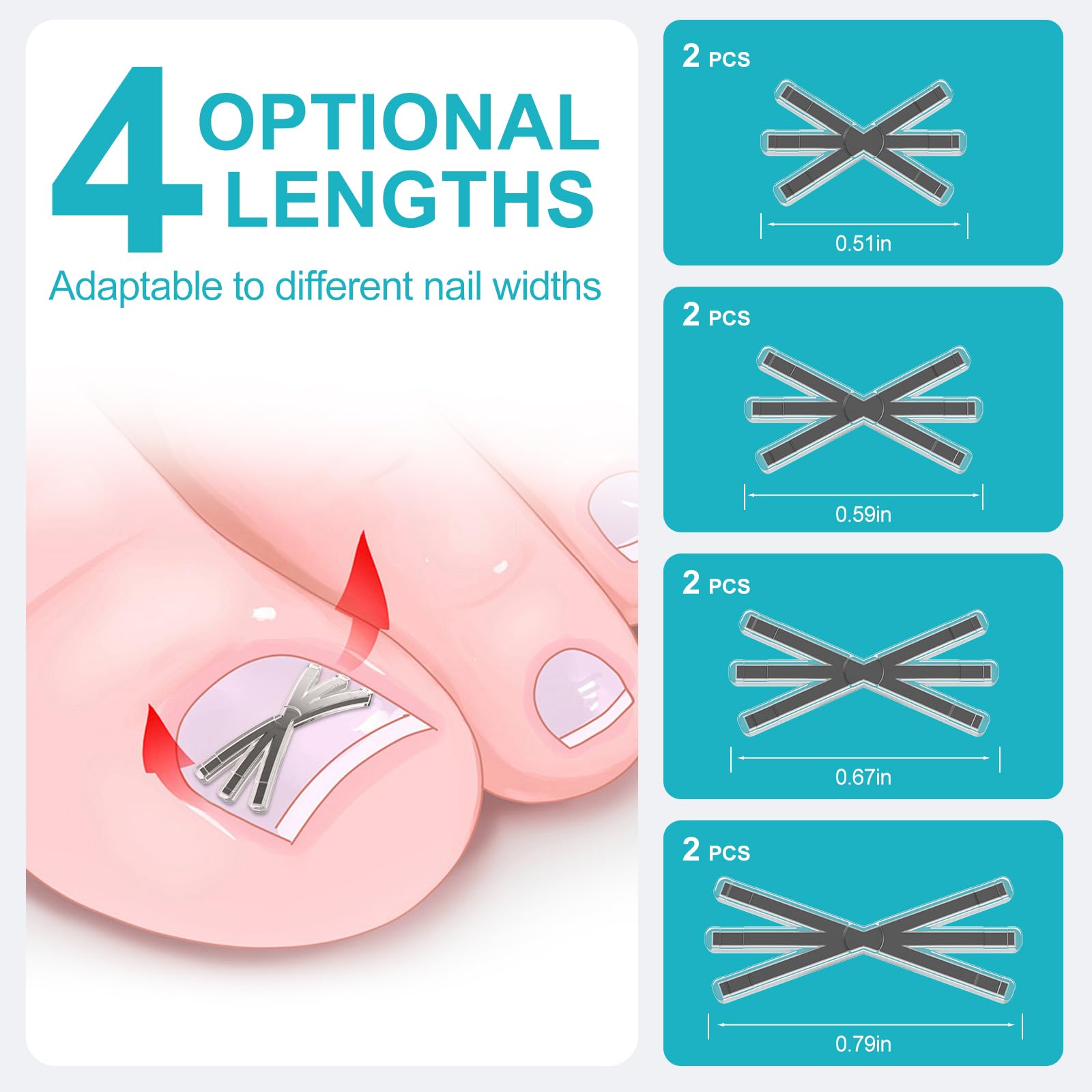 VITASY titanium alloy corrector detail highlights durable, high-precision nail realignment.