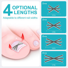 VITASY titanium alloy corrector detail highlights durable, high-precision nail realignment.