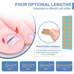 VITASY titanium alloy ingrown nail corrector tools for curved nails and durable performance.
