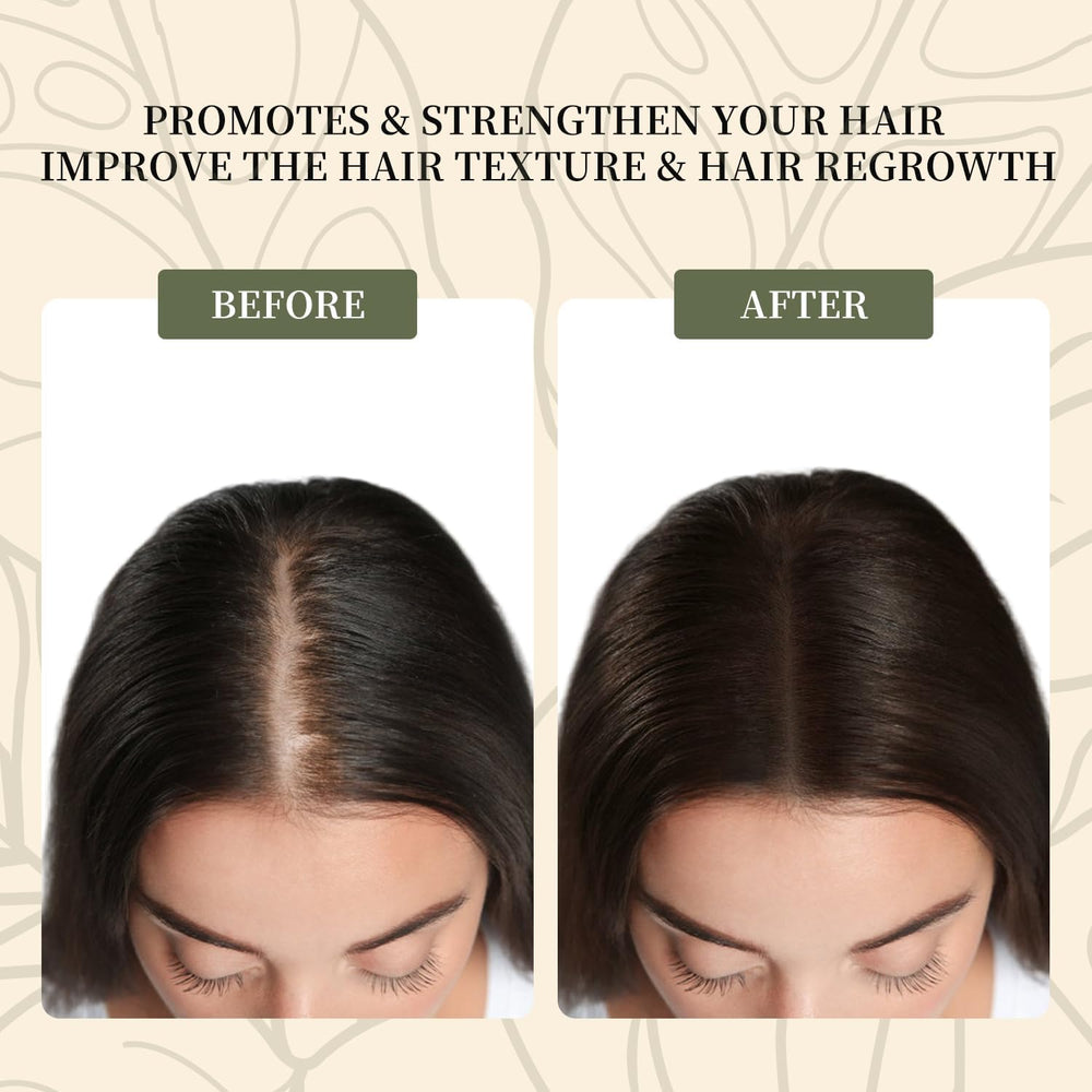 Vivccon Batana Oil nighttime treatment for recovery while you sleep.
