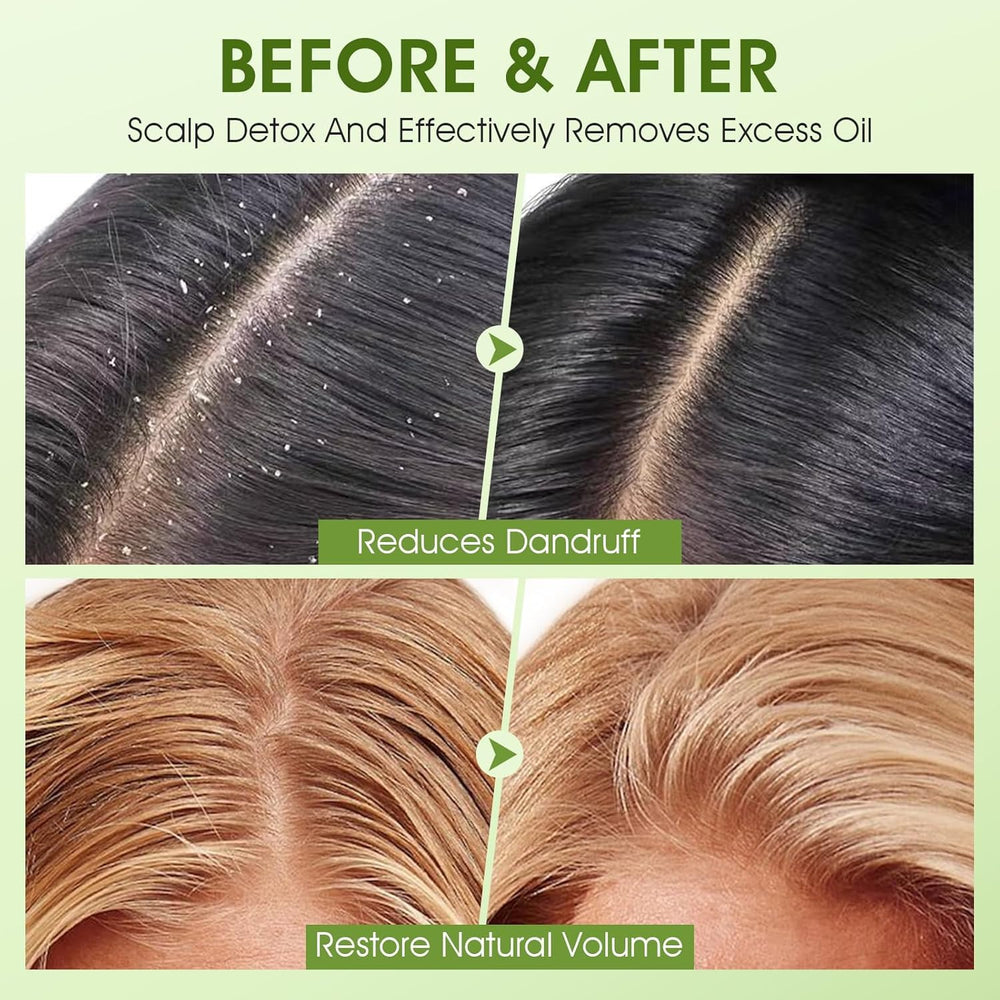 VOERUY 10% AHA and 10% BHA blend for gentle exfoliation.