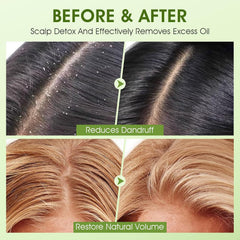 VOERUY 10% AHA and 10% BHA blend for gentle exfoliation.