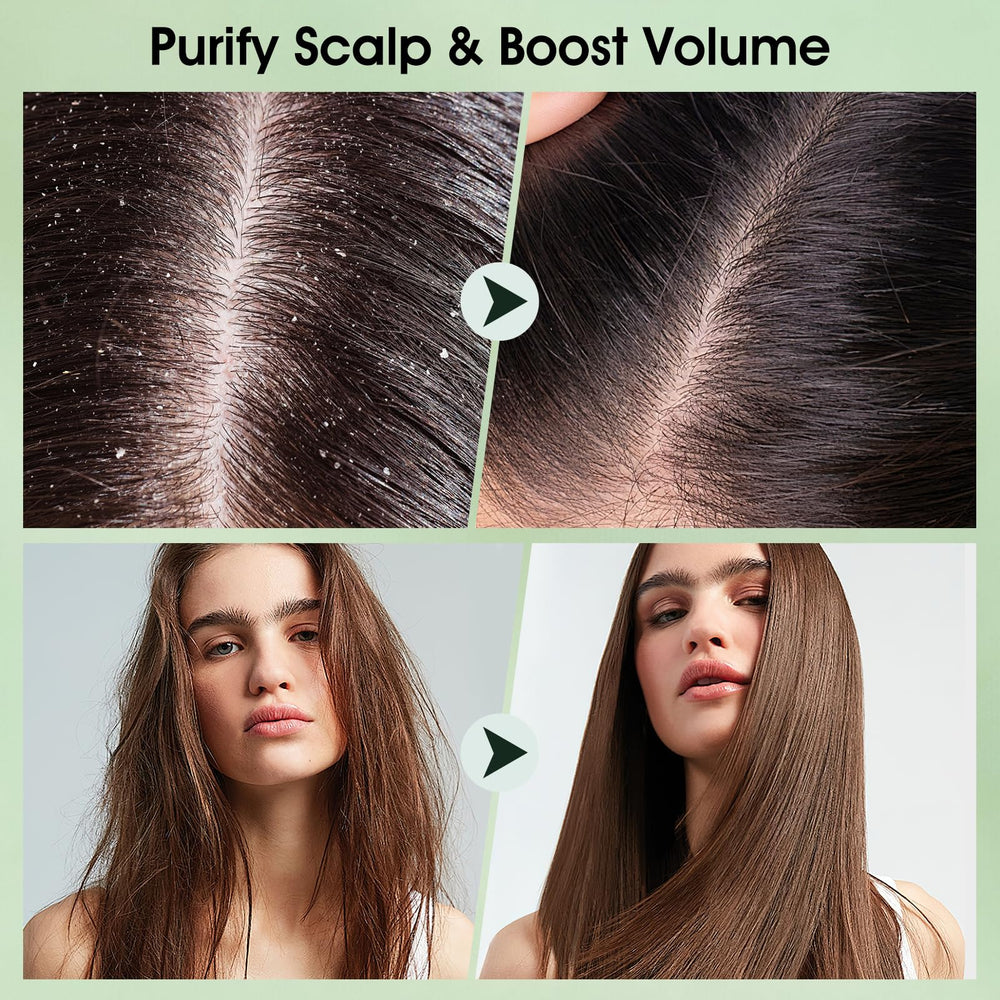 VOERUY silicone scalp massager demonstrates at-home scalp massage.
