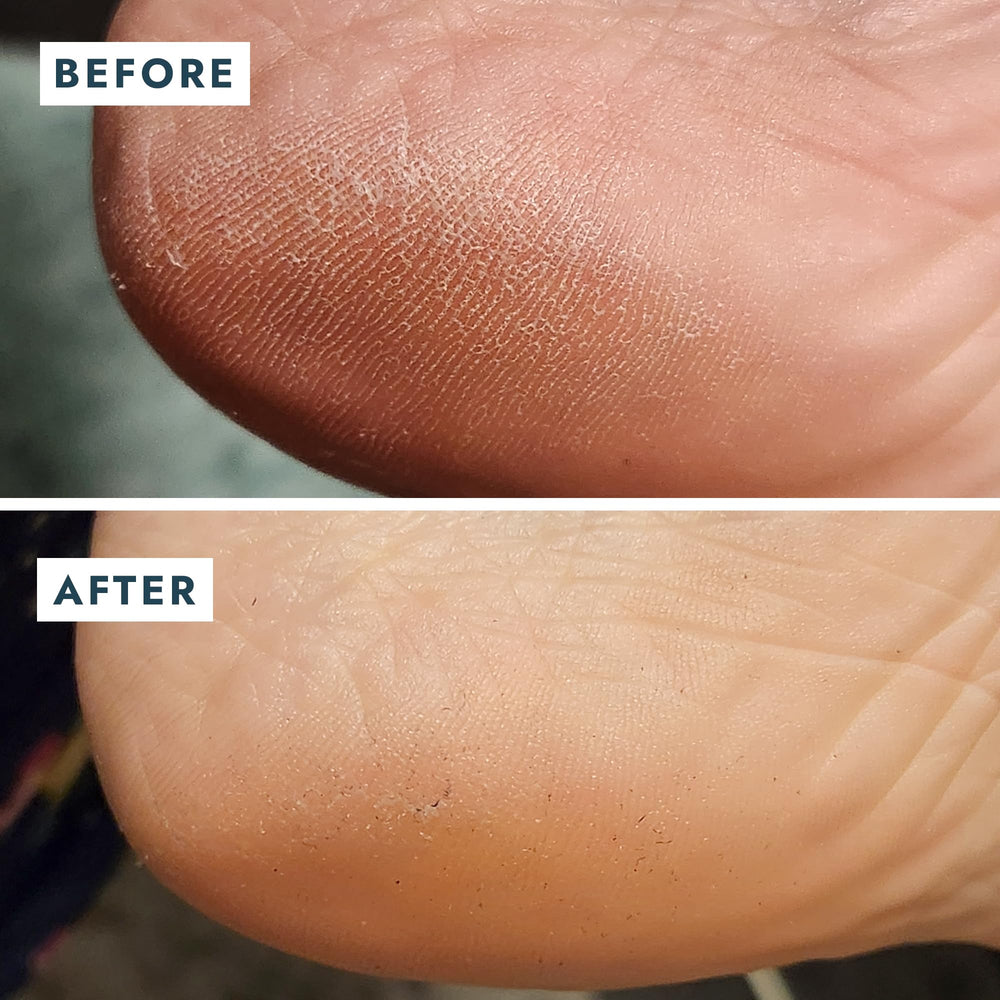 VOESH Solemate softened-heels shows improved texture after use