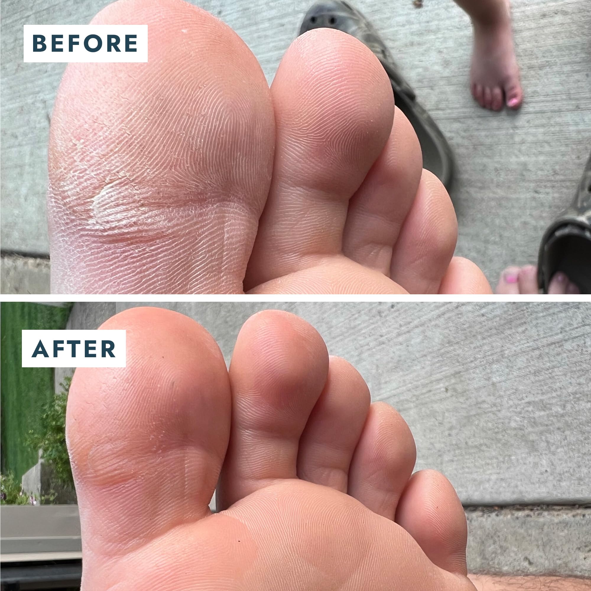 VOESH Solemate travel-size compact presents convenient travel foot care